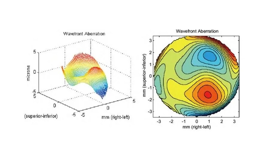 波前像差(波陣面像差)的基本知識 波前像差(波陣面像差)的基本知識