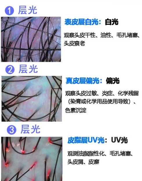 不同光對頭發的觀測效果 不同光對頭發的觀測效果